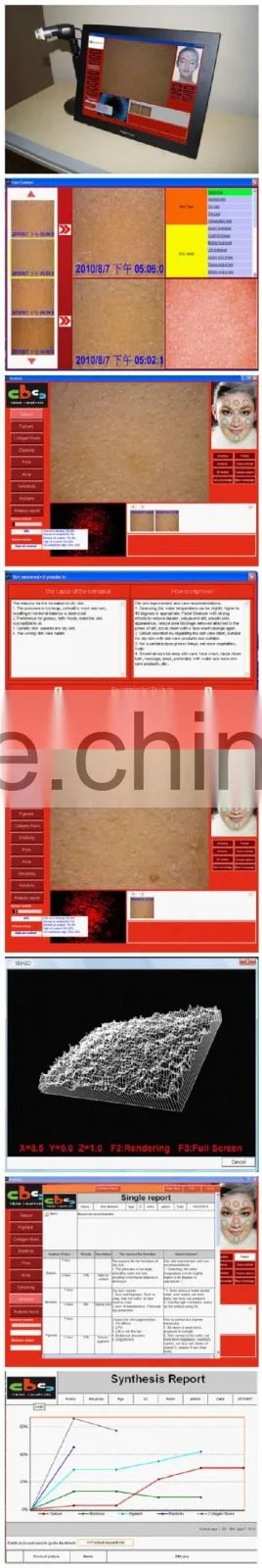 Latest products in market digital skin test equipment