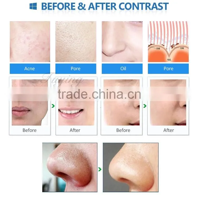 Facial beauty machine micro crystal diamond dermabrasion machine