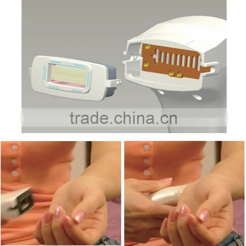 innovative products for import hair loss treatment lumenis ipl quantum For hair removal