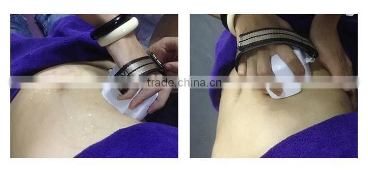 4D 32kHZ cavitation equipment for weight loss