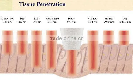 Medical equipments laser diode hair removal machine hair loss treatment diode laser 808