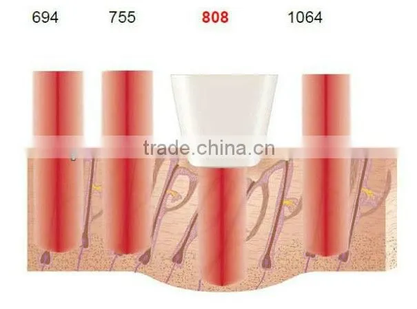 2013 Most advanced technology 808nm diode laser for hair removal machine