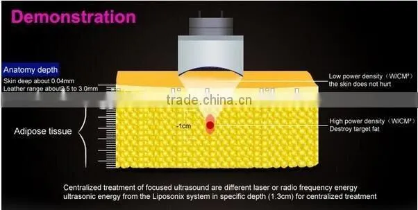 Professional Face Lift Hifu Ultra Slimming Machine With Liposonix