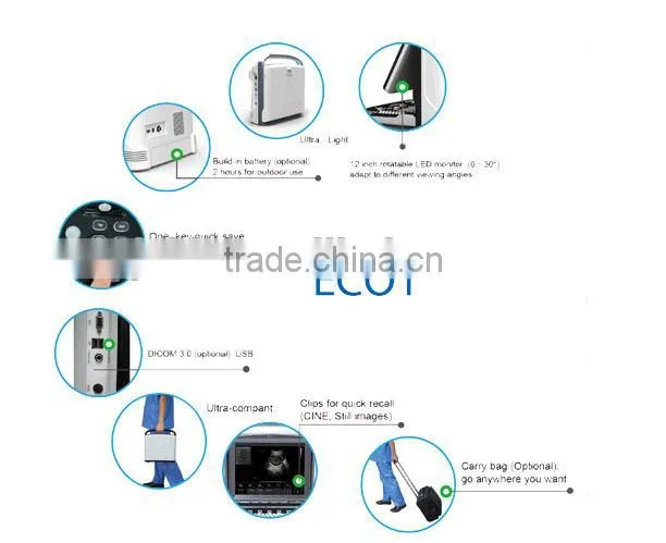 CE approved 3.5Mhz convex probe Portable Veterinary Ultrasound Scanner for pets