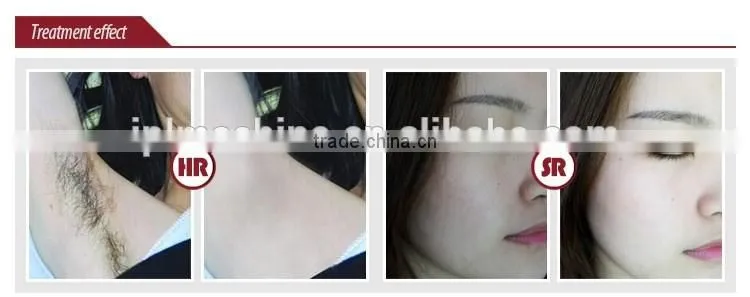 CE approval mini ipl machine