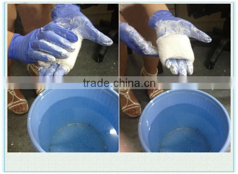 2015 Hot Medical Pop Bandage Plaster Cast