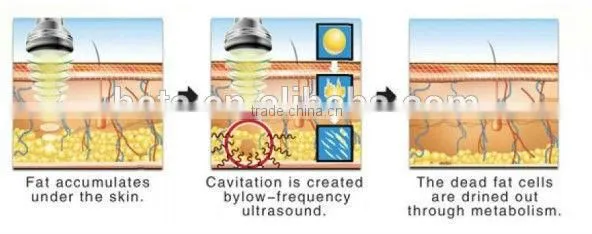 Heta H-1001 Factory price body slimming beauty rf ultrasonic cavitation portable equipment