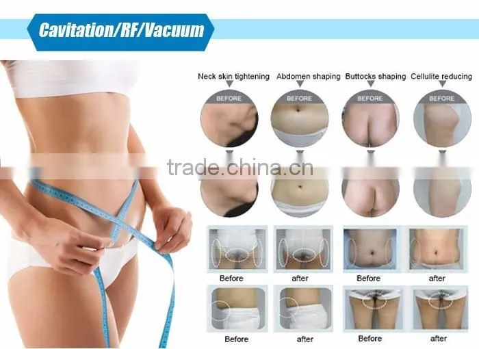 CE approved 5 in 1 weight loss mono polar ultrasound slimming skin tightening