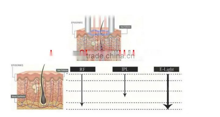 multifunctional e light ipl rf beauty equipment