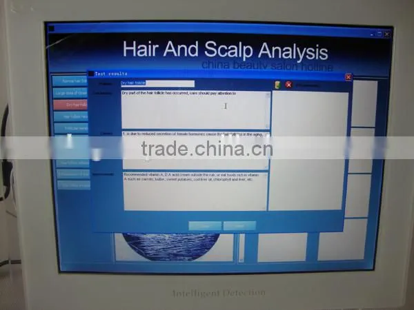Degital Magic Mirror Hair Analysis Machine
