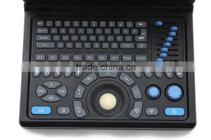 2016 CE&ISO Best Price of Portable/Notebook/Laptop ultrasound Scanner/machine with convex, linear, vaginal, rectal transducer