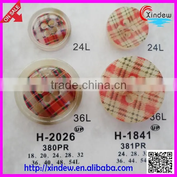 Fashion design coat buttons/shirt buttons/High-end clothing buttons