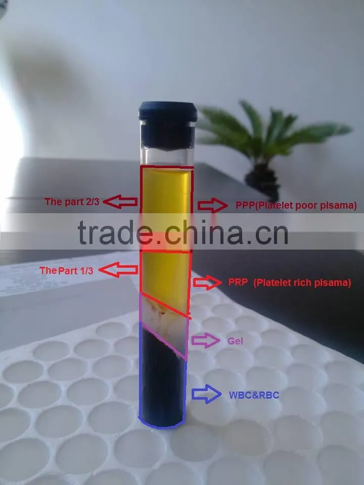 High concentration platelet rich plasma PRP tube