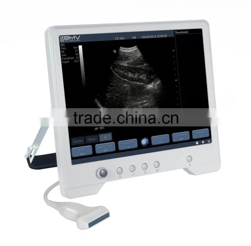 ultrasound machine 3d laptop touch screen B-ultrasound scanner TS20