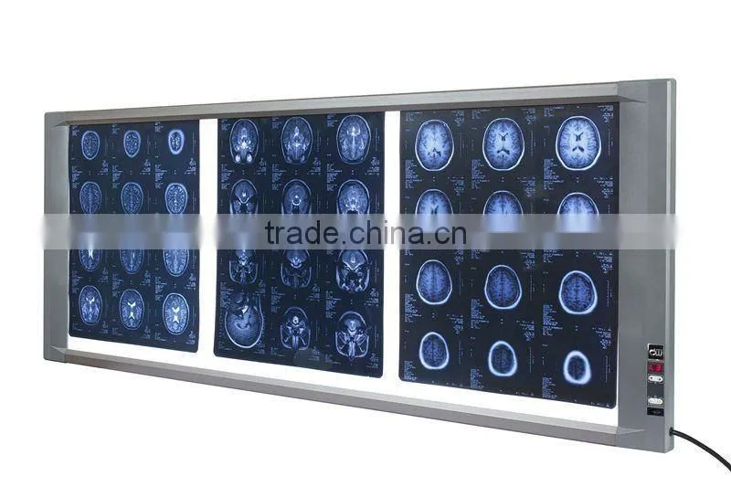 medical equipment of LED X-ray film