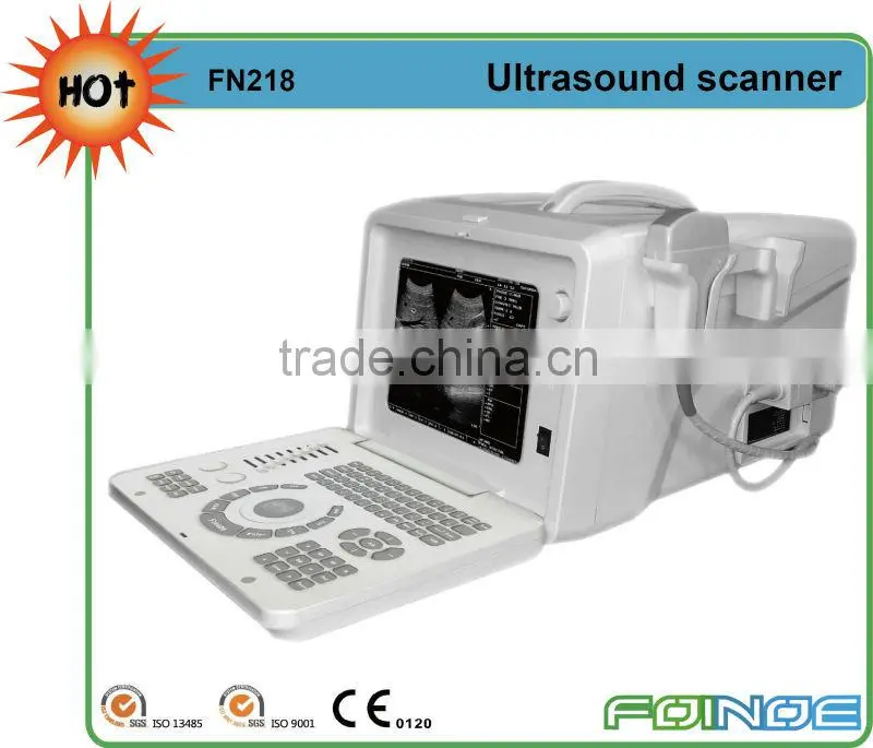 FN218 Full digital B model ultrasound probe usb