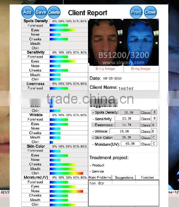 Newest 3D magic mirror visia skin analysis machine
