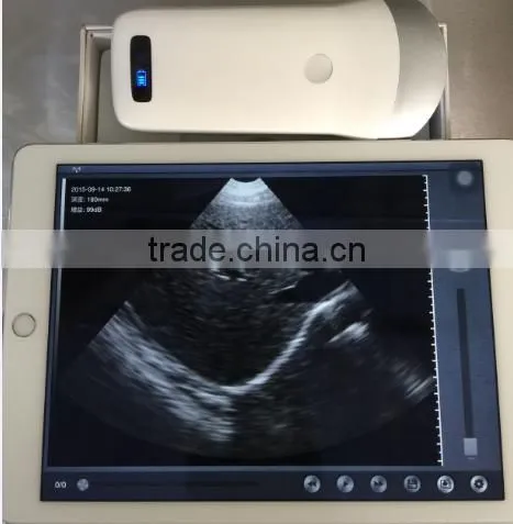 Excellent Portable Wireless Ultrasound Transducers for sale -WBU01