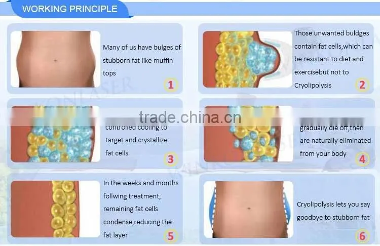 Cryolipolysis Beauty Salon Equipment / Fat Freezing Beauty Salon Equipment / Lipo Cryo
