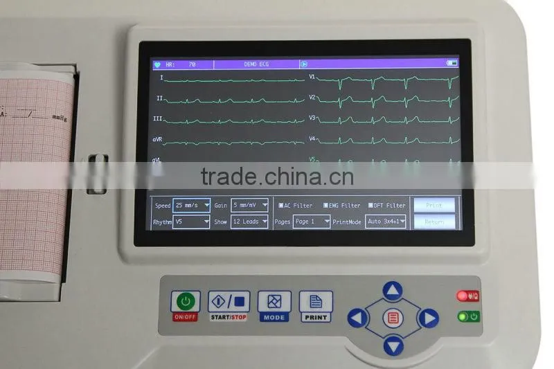 Hot Sale Portable Digital 6-channel Software Electrocardiograph 7 Inch Color Touch Screen ECG Machine EKG Machine EKG-923-Shelly