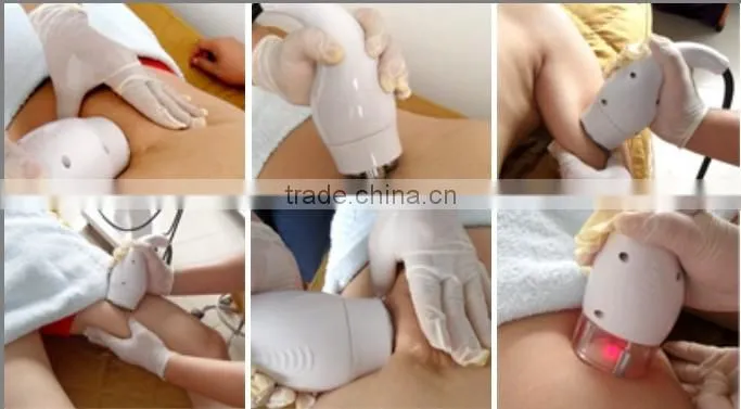 home use effective fat removal machine