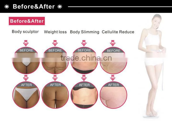 Ultrasonic Cavitation Cellulite Treatment Machine