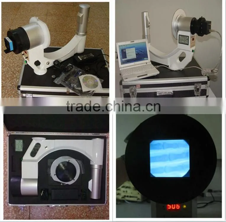 X Ray Machine