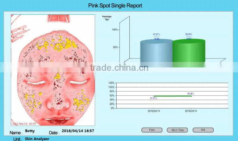 2016 popular portable magic mirror skin analyzer skin analysis machine