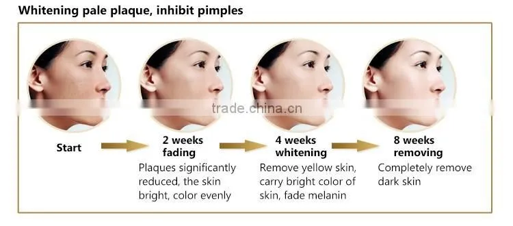 New products 2015 Innovative Product beauty skin electrical facial mask