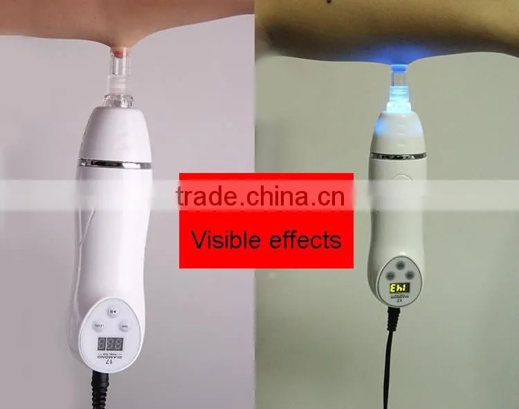 2016 Hot sale!! CE Certificated Micro Dermabrasion Peeling Machine Blackhead Remove Machine for Skin Beauty