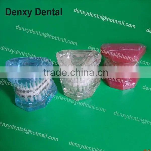 dental manufacturer Hot-sell ceramic red teeth orthodontic model