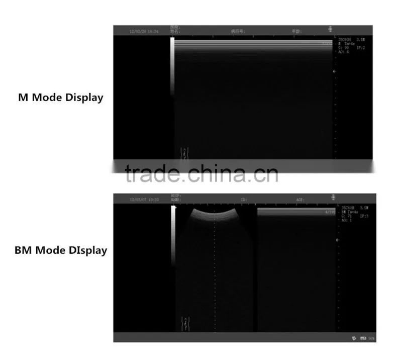 CE Full Digital Medical Ultrasound for animal