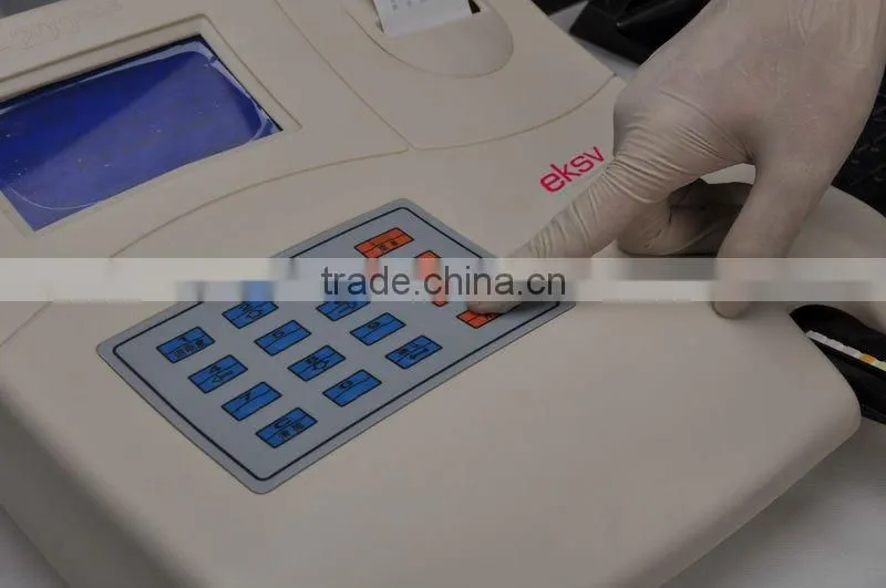 4 Test Items Urinalysis Analyzer