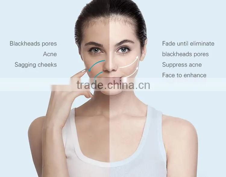 WOW!! SHR Skin Tightening & Permanent Hair Removal Equipment hig quality