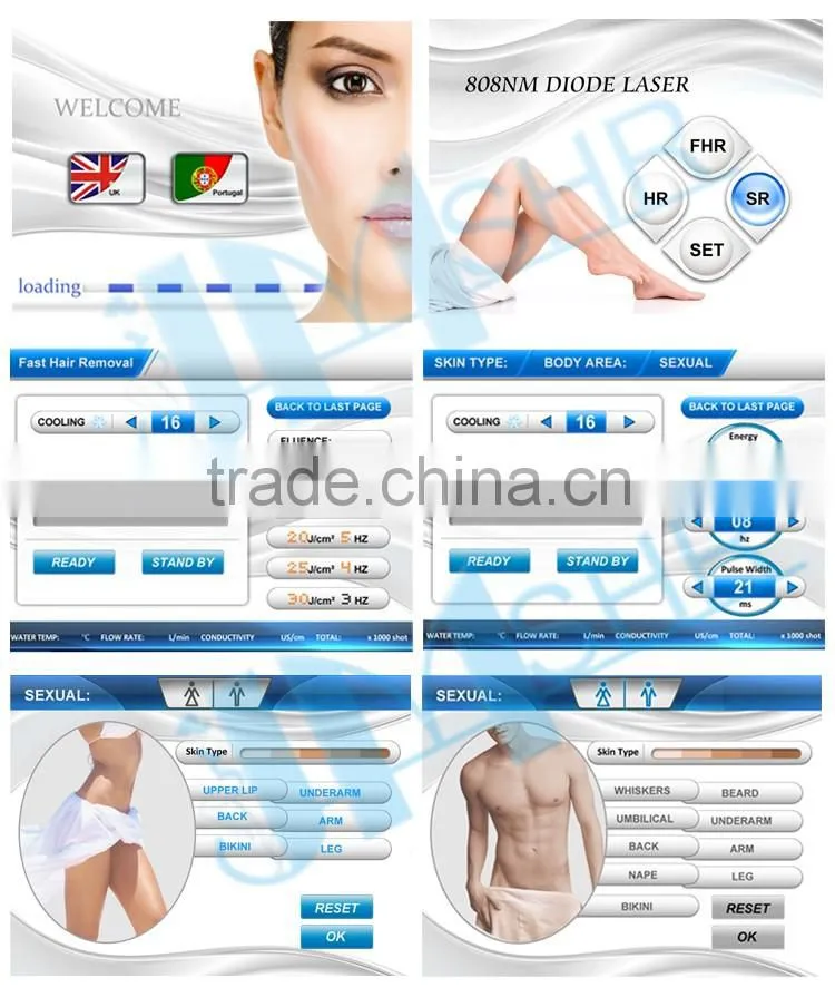 Hot sale Vertical 808nm Diode Laser Hair Removal