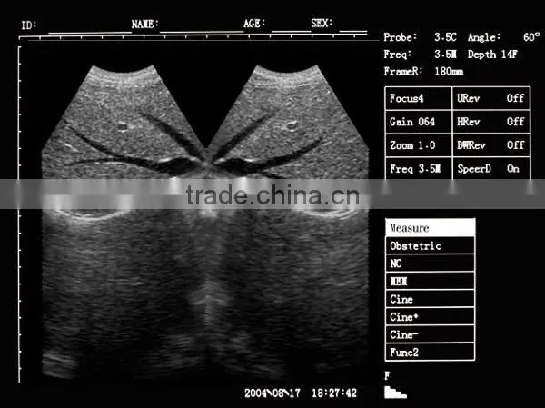 MSLPU25A HOT SALES Digital best Medical portable china portable ultrasound machine price