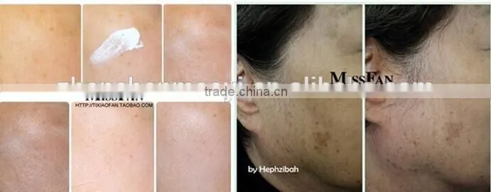 Best Lemon Papaya Whitening and Freckle Spots Remove Cream Aichun Freckle Removing Cream
