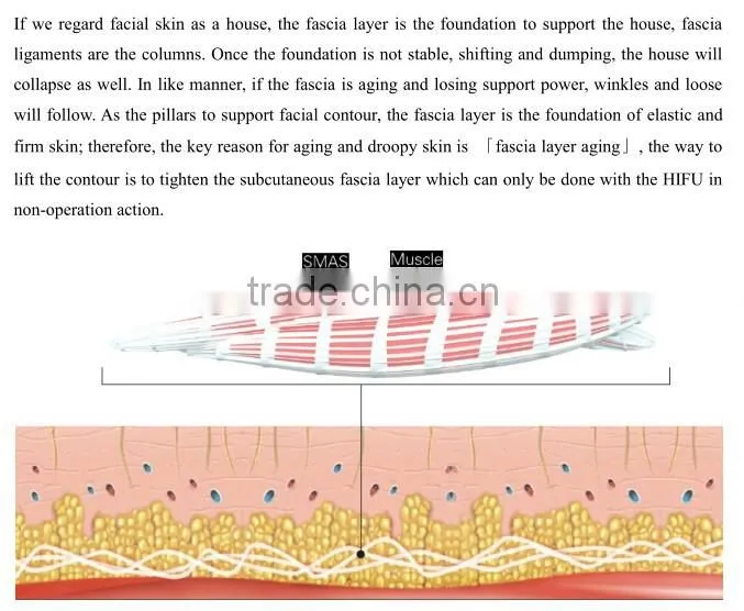 face lifting china beauty spa equipment / hifu beauty salon equipment