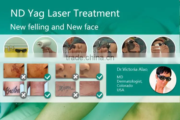 Q Switched Laser Tattoo Removal IPL System Hair Removal
