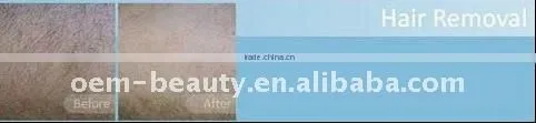 Intense Pulsed Light (IPL) Hair Removal and body epilator
