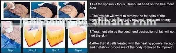 Hifu Liposonix Body Slimming Ultrasound Machine With High Effects