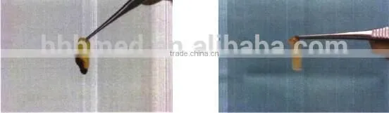 Vacuum sterile and pyrogen free platelet rich fibrin PRF tube
