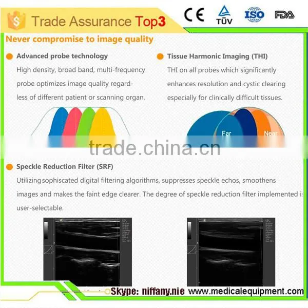 3D Color Doppler Ultrasound Machine with touch screen with competitive price MSLCU22-N