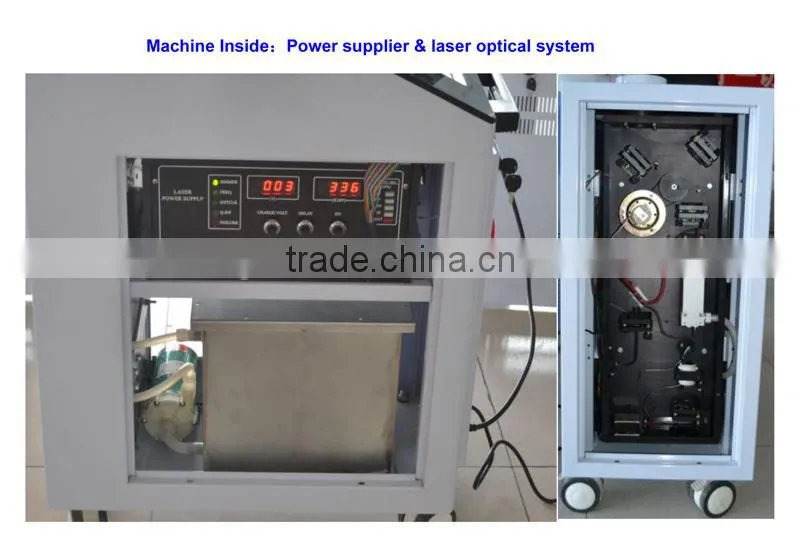 2016 new year best Q-Switch nd yag laser tattoo removal treatment machine