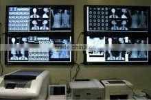 agfa digital film,medical x-ray image intensifier,t4 diagnostic
