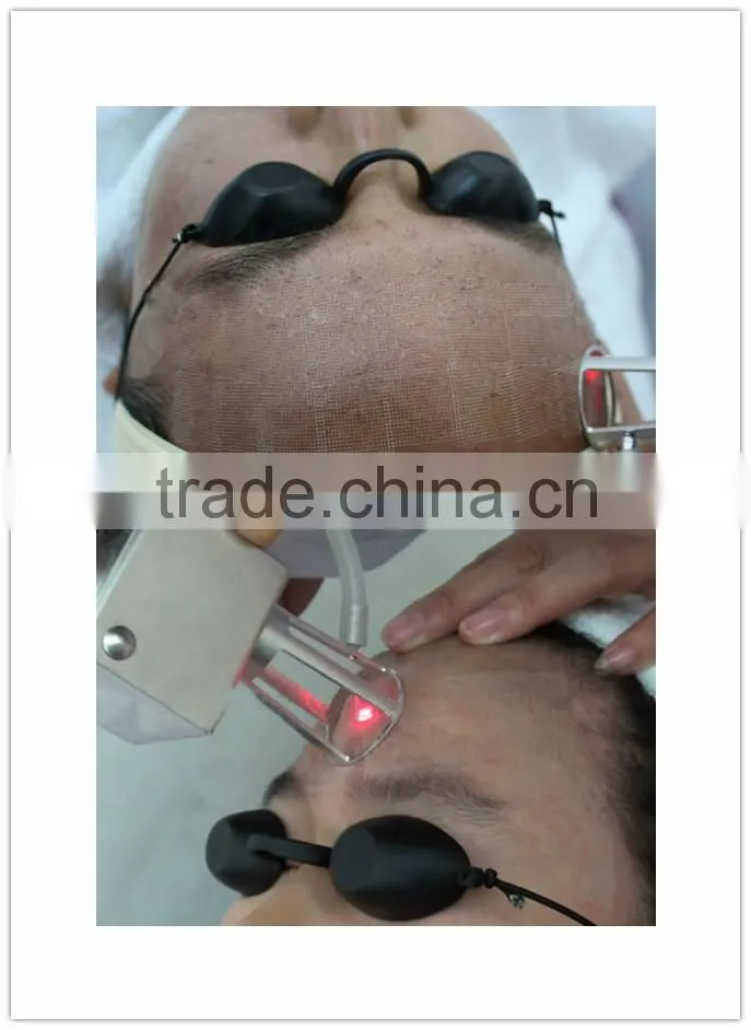 perfect Vaginal tightening fractional co2 laser /co2 fractional laser for scar removal