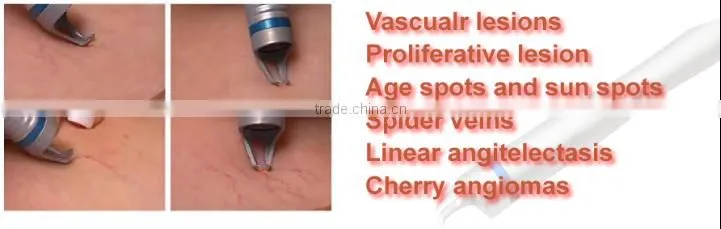 Spider Vein Removal Machine Vascular Removal 980nm Medical Beauty Diode Laser Machine