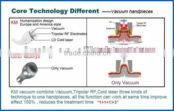 Professional and hot sale cavitation rf vacuum machine
