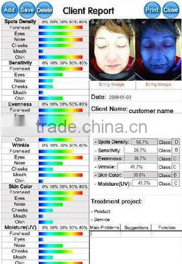 VY-M01 Magic skin and hair analysis machine