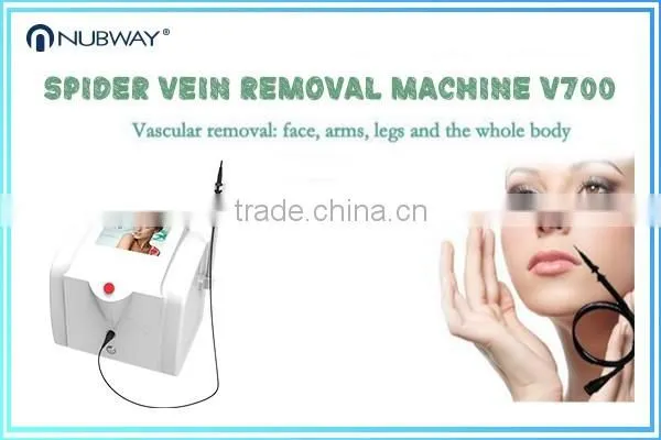 USA Hot Sales NUBWAY Portable Mini Skin Tag Removal Lamprobe Machine